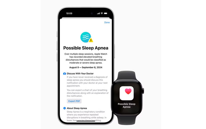 Apple Watch Series 10
