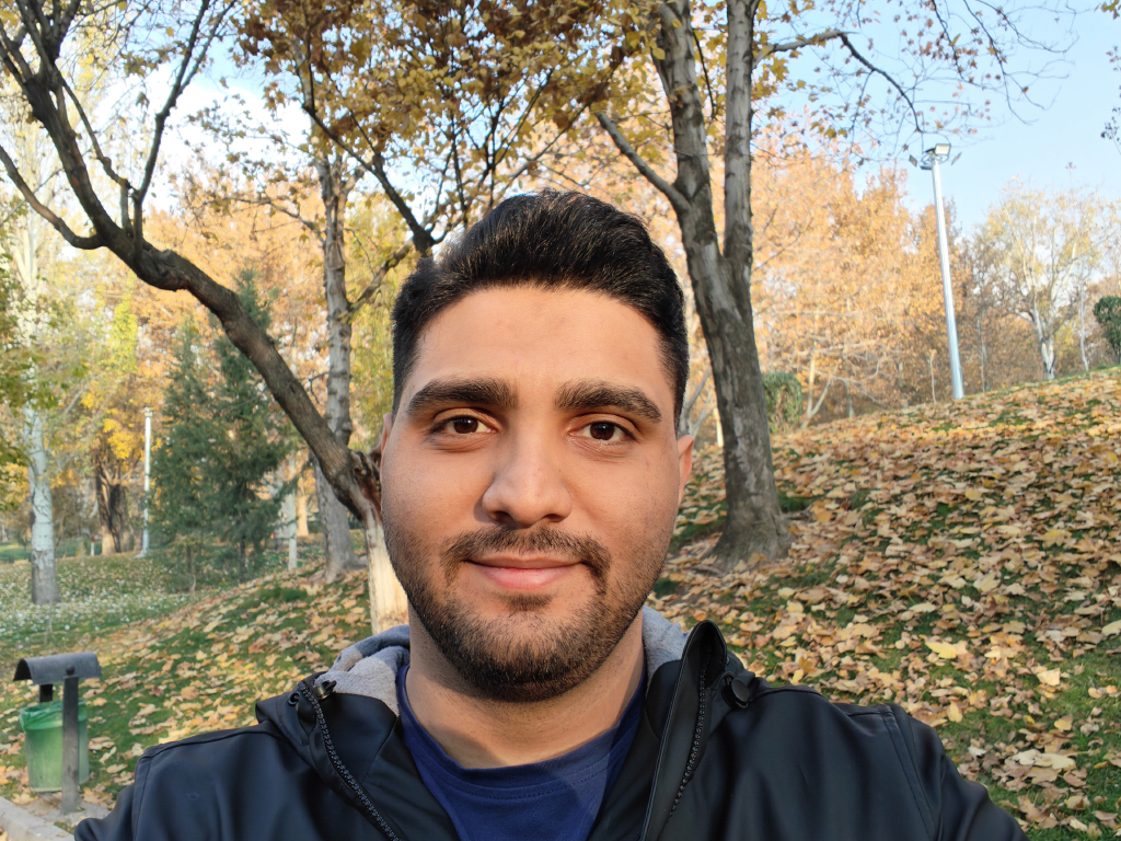 دوربین سلفی Honor 400 Pro