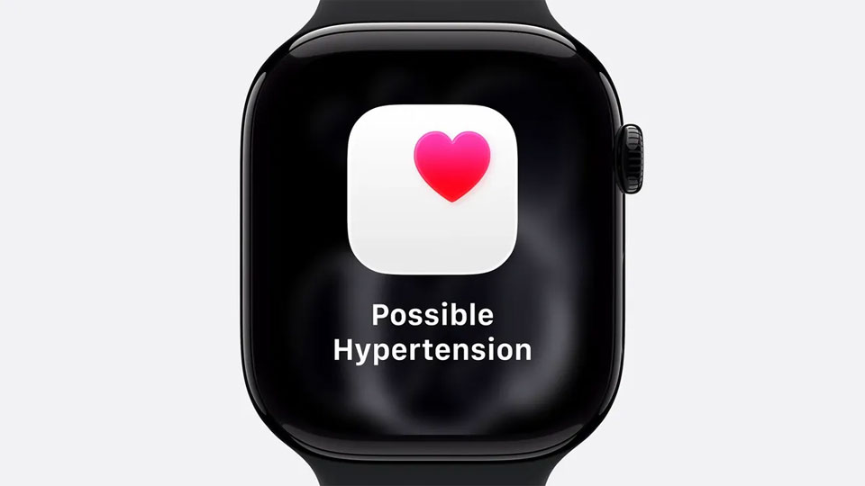 apple watch series 11